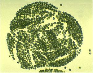 研究发现蓝藻代谢与环境适应新途径